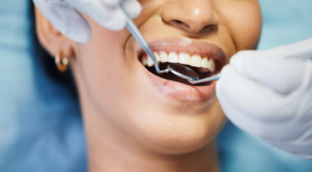Best Urgent Care for Lost Fillings or Crowns in Bayside, WI