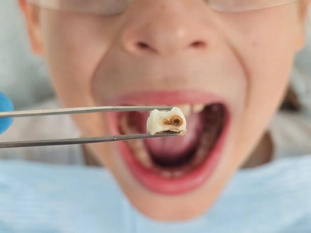 Best Cosmetic Emergency Dentistry in Bayside, WI